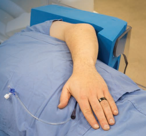 StandTall Vascular Sheath Extender and Left Arm Support System (LASS)
